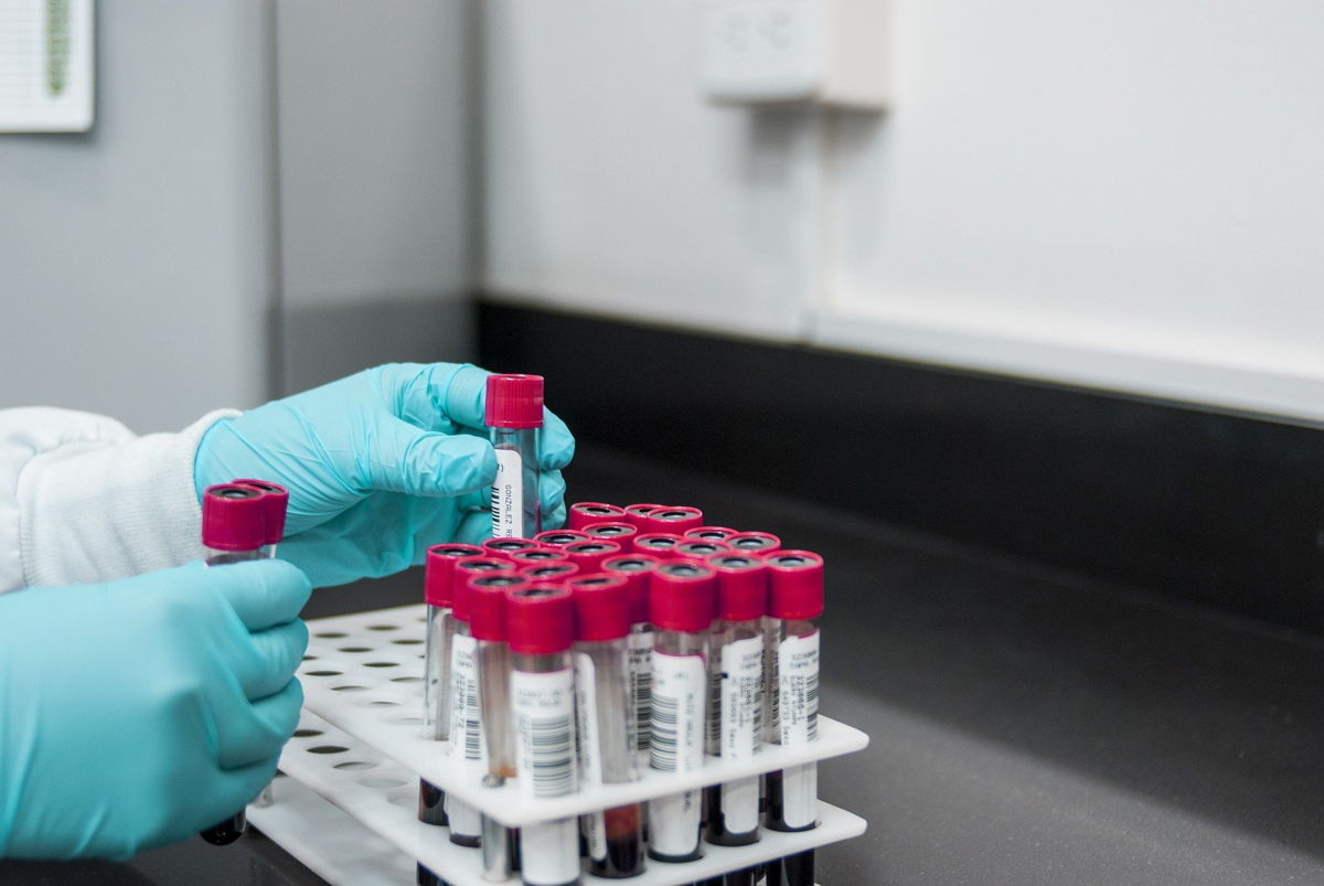 La Inteligencia operativa impulsa la producción de químicos esenciales en la nueva normalidad